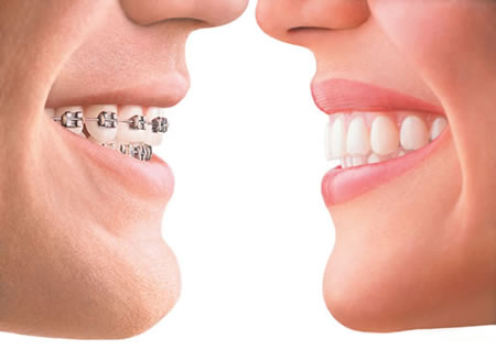 UploadImage/27885Orthodontic Treatment.jpg